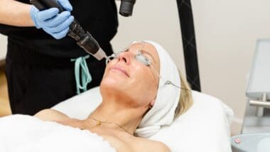Laser fractionné : traitez plusieurs imperfections du visage