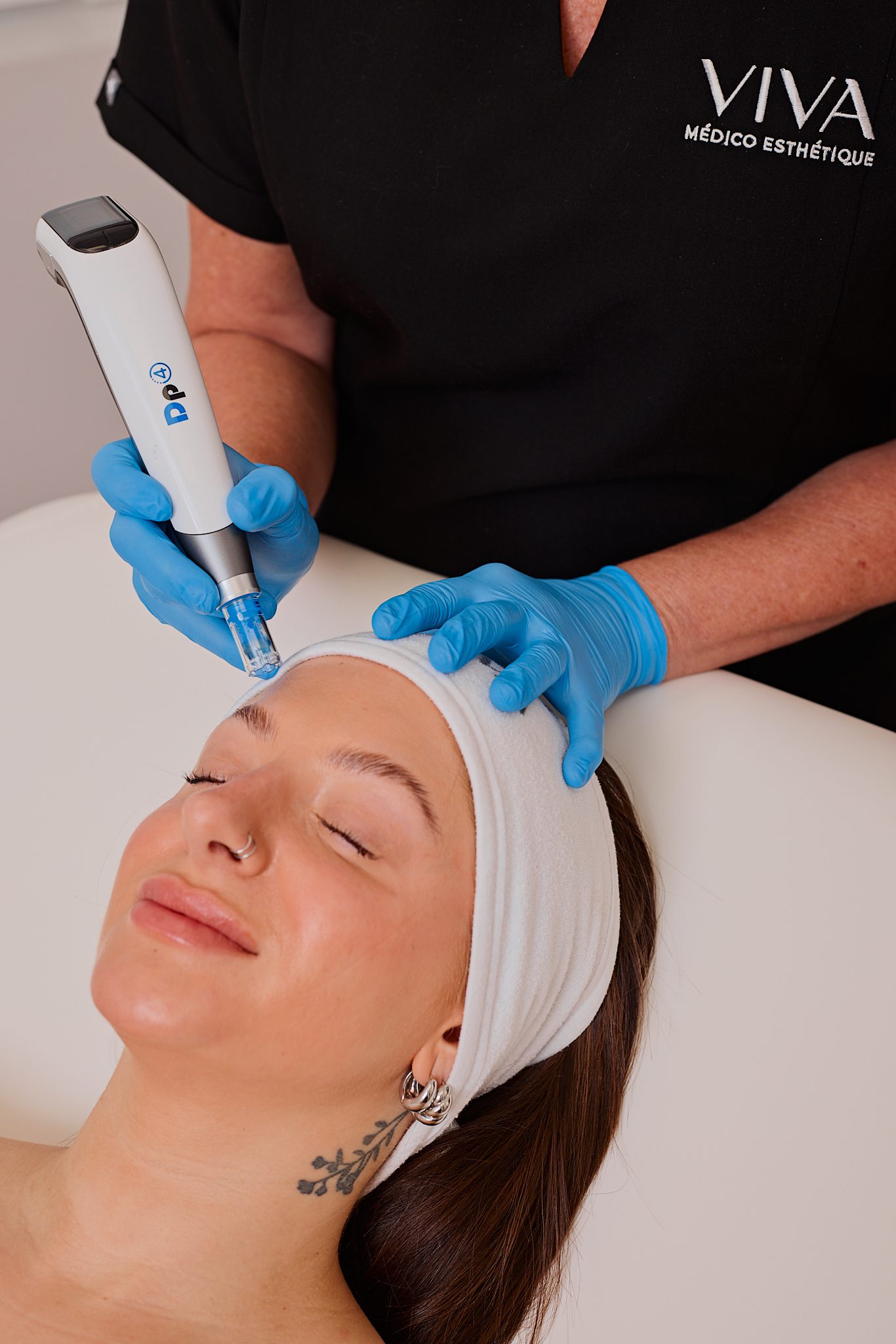 Microneedling DP4