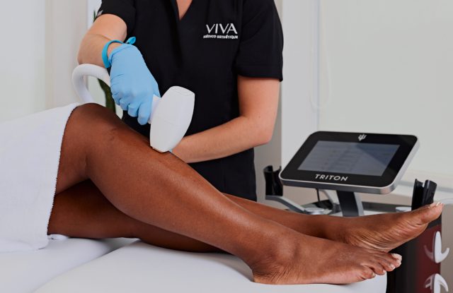 Épilation laser Triton : la technologie de pointe pour une peau lisse durablement