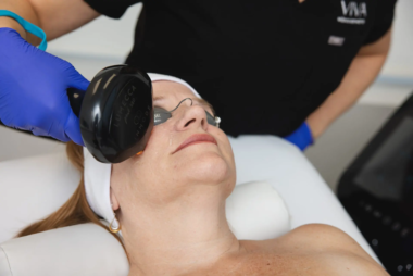 IPL Lumecca Peak: atténuez vos taches pigmentaires et rougeurs